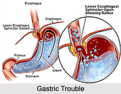 Gastric Trouble, Stomach Ailment