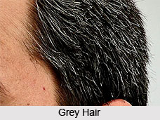 Premature Greying of Hair