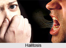Halitosis