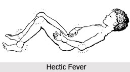 Hectic Fever or Pralepaka Jwara