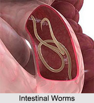 Intestinal Worms, Stomach Ailment