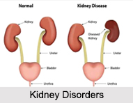 Kidney Disorders, Naturopathy