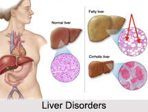 Liver Disorders, Stomach Ailment