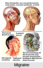Yoga for Headache, Yoga and Health