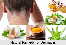 Natural Remedy for Dermatitis, Naturopathy