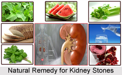 Natural Remedy for Kidney Stones, Indian Naturopathy
