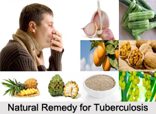 Natural Remedy for Tuberculosis, Indian Naturopathy