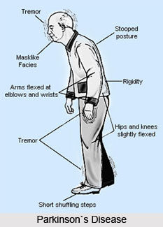 Causes of Parkinson`s Disease