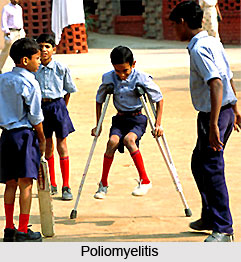 Poliomyelitis or  Balapakshaghata
