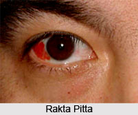 Haemorrhage or Rakta Pitta