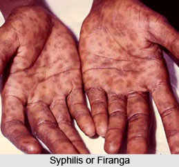 Syphilis or Firanga