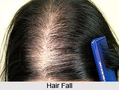 Causes of Hair Fall