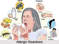 Allergen, Causes of Allergies