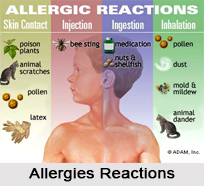 Allergies