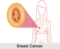 Female Diseases, Naturopathy