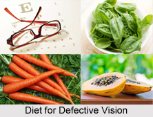 Natural Remedy for Defective Vision, Indian Naturopathy