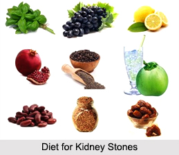 Kidney Stones, Kidney Disorder