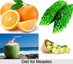 Natural Remedy for Measles, Naturopathy