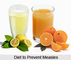 Measles