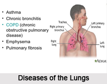 Chest Ailments, Naturopathy