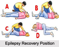 Epilepsy, Neurological Disorder