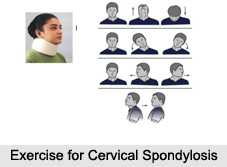 Cervical Spondylosis, Joint and Muscle Ailments