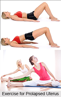Natural Remedy for the Prolapse of Uterus, Naturopathy