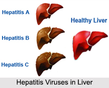 Liver Disorders, Stomach Ailment