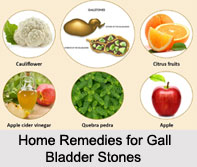 Gall Bladder Stones, Naturopathy