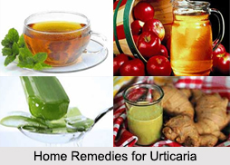 Urticaria, Allergic Disease