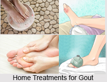 Natural Remedy for Gout, Indian Naturopathy