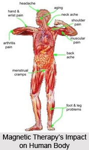 Advantages of Magnetic Therapy