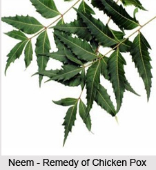 Treatment of Chicken Pox