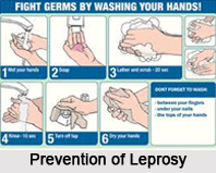 Leprosy, Naturopathy