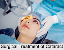 Cataract, Eye Disorder