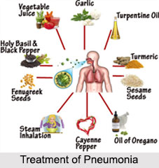 Pneumonia, Chest Ailment