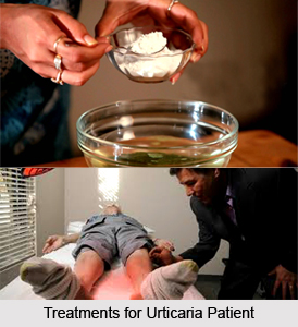 Treatments of Urticaria