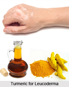 Natural Remedy for Leucoderma, Indian Naturopathy