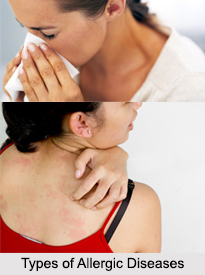 Allergic Diseases, Naturopathy
