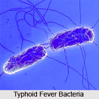 Types of Common Fever
