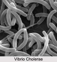 Cholera, Stomach Ailment