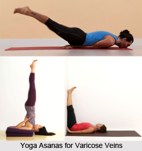 Natural Remedy for Varicose Veins, Indian Naturopathy