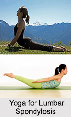 Lumbar Spondylosis, Joint and Muscle Ailment