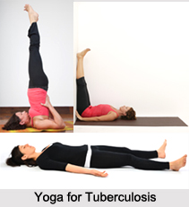 Natural Remedy for Tuberculosis, Indian Naturopathy