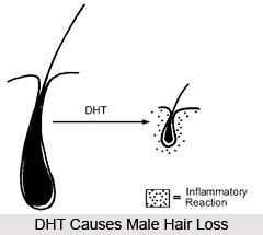 Causes of Hair Fall