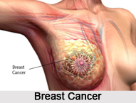 Cancer, Naturopathy