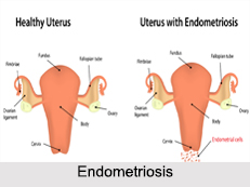 Female Diseases, Naturopathy