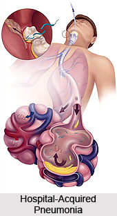 Types of Pneumonia