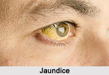 Raw Juice Therapy, Indian Naturopathy