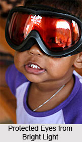 Trachoma or Pothaki